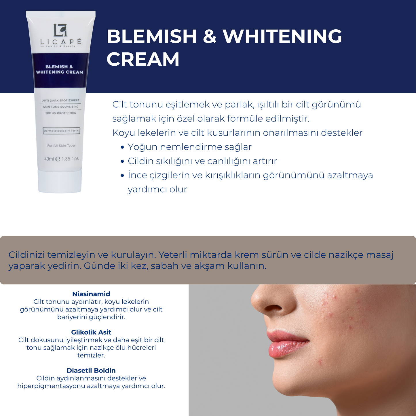 Leke Kremi Ve Cilt Beyazlatıcı Krem 40ml