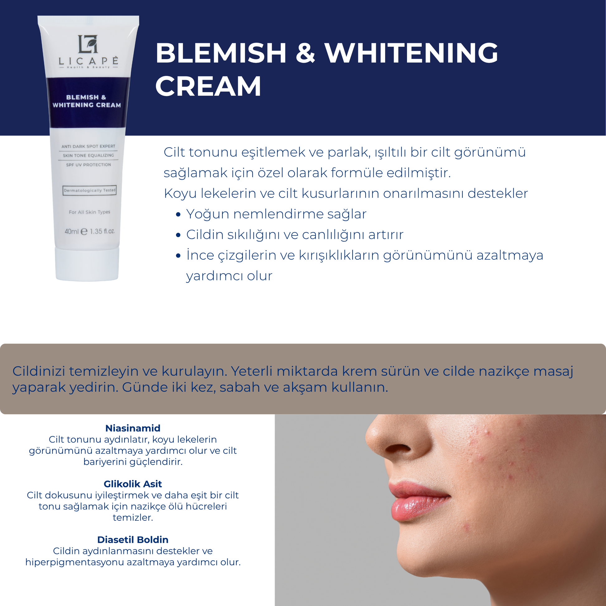 Leke Kremi Ve Cilt Beyazlatıcı Krem 40ml